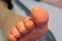 Claw Toes